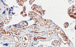 PIK3C2A Antibody, Novus Biologicals 0.1mg; Unlabeled:Antibodies, Polyclonal